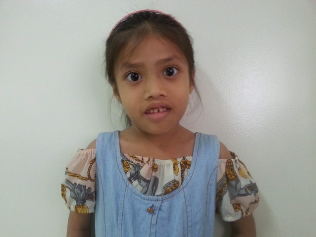 Sothea