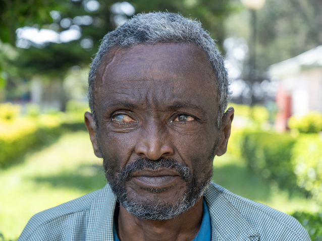 bekele-from-ethiopia-raised-150-to-fund-sight-restoring-cataract