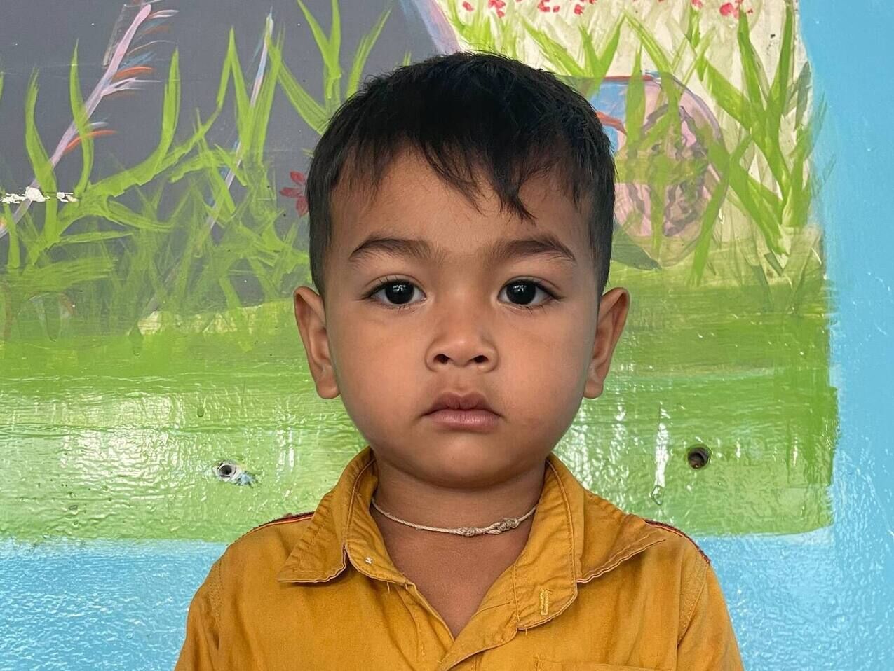 Success! Ravin from Cambodia raised $652 to fund burn contracture ...