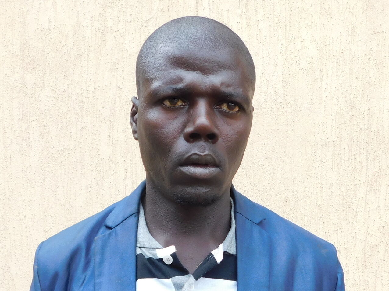 Success! Aggrey from Uganda raised $170 to fund a hernia repair ...