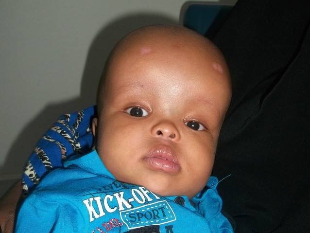 Abdifatah