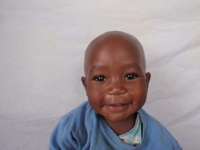 Shiraf from Tanzania raised $1,160 to help him walk properly. | Watsi