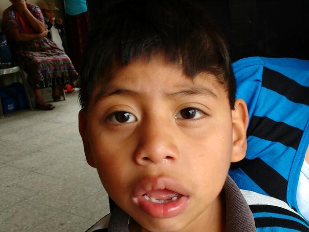 Alex