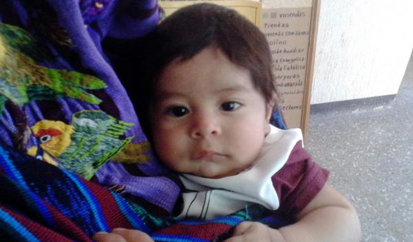 Photo of Gregorio post-operation
