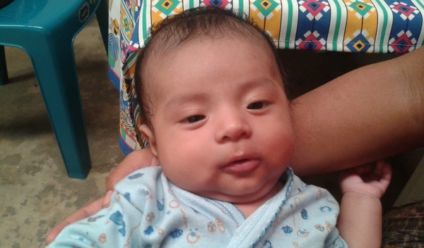 Photo of Libni post-operation