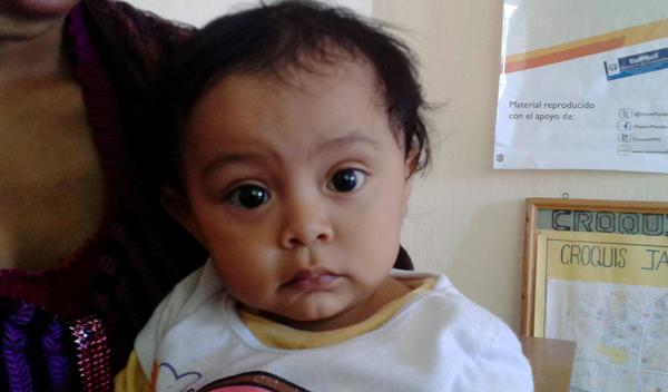 Photo of Cecilia post-operation