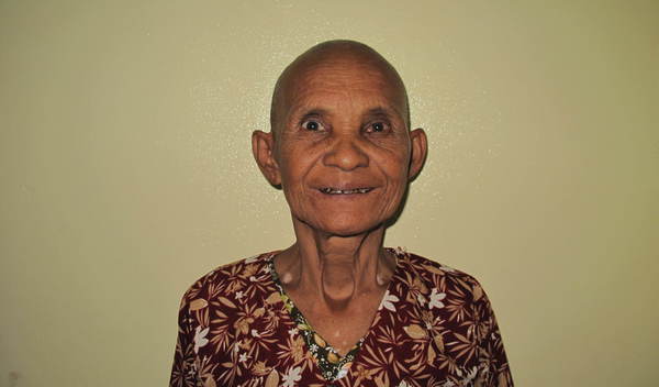 Photo of Morn post-operation
