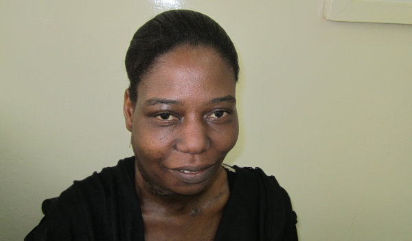 Photo of Neema post-operation