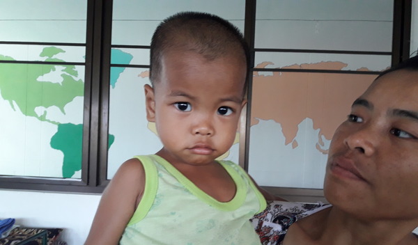 Photo of Zar Ni post-operation