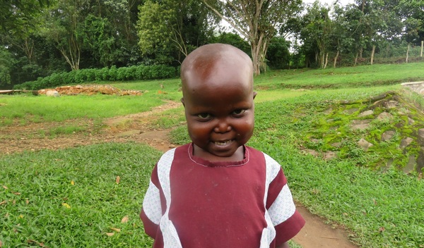 Photo of Marvious post-operation