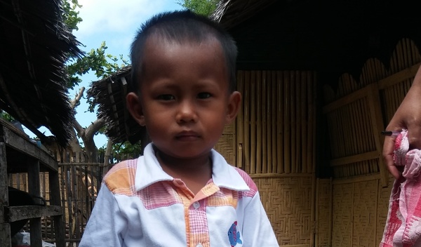 Photo of EJaymar post-operation