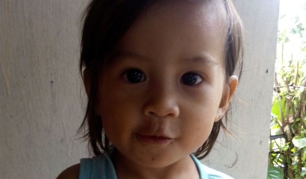 Photo of Marife post-operation