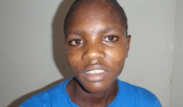 Photo of Ngaikiinyi post-operation