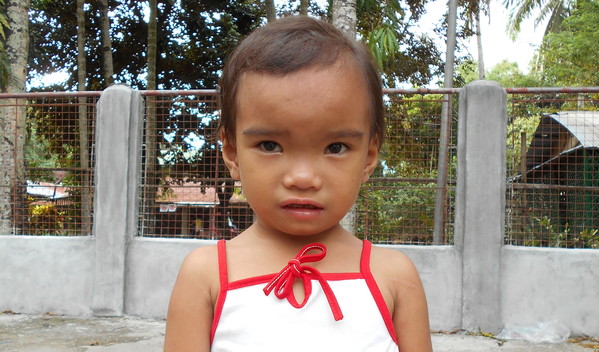 Photo of Edna Mae post-operation