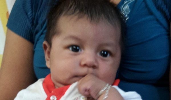 Photo of Maria post-operation