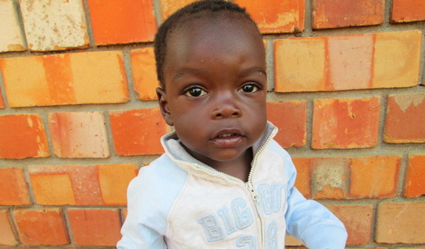 Photo of Musinguzi post-operation