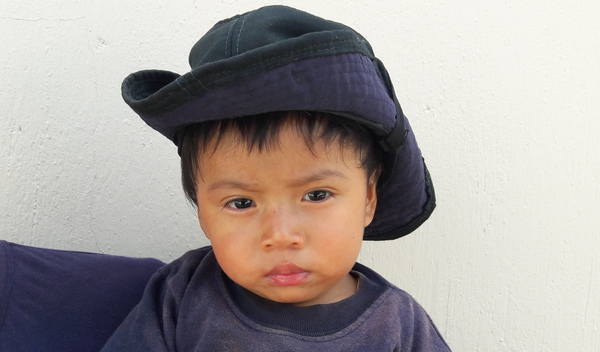 Photo of Yohan post-operation