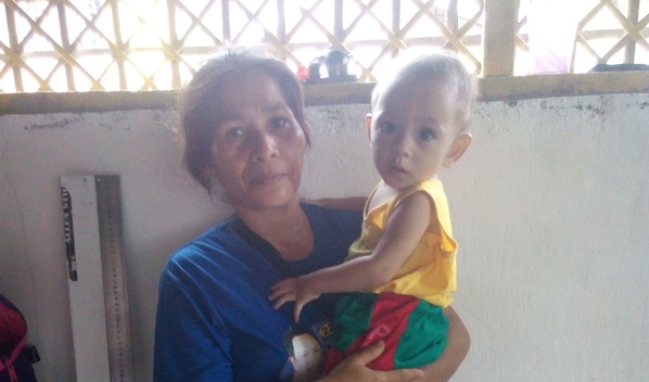 Photo of Nor-Nor post-operation