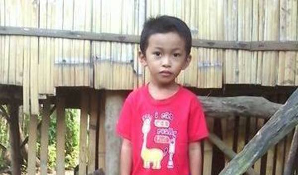 Photo of Klint Jhon post-operation