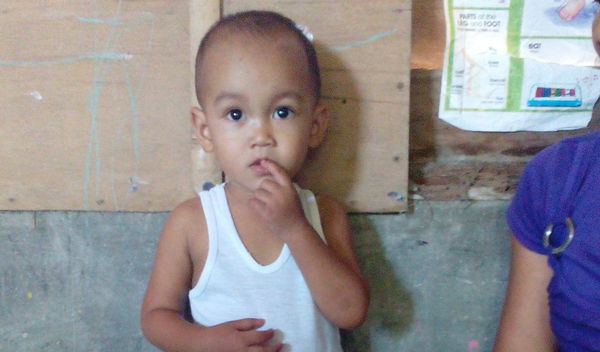 Photo of Dhel post-operation