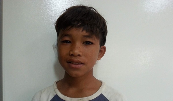 Photo of Veasna post-operation