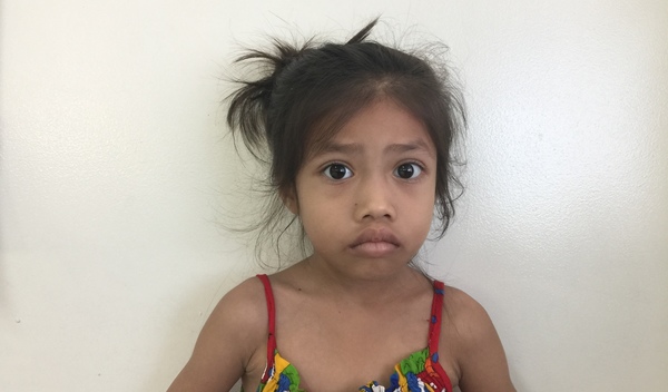 Photo of Sothea post-operation