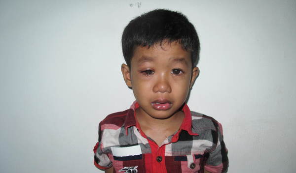 Photo of Salith post-operation