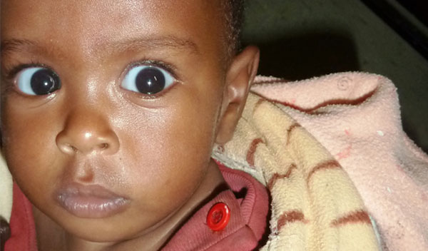 Photo of Abezash post-operation