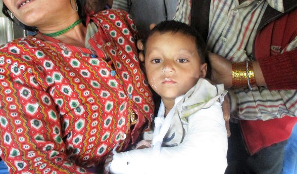 Photo of Jeevan post-operation