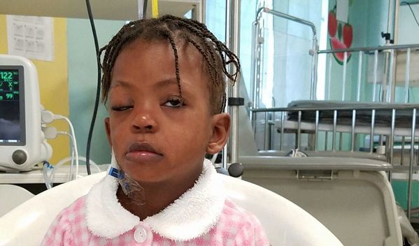 Photo of Malia post-operation
