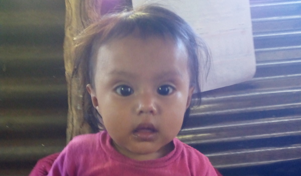 Photo of Leydi post-operation