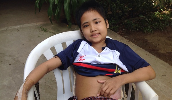 Photo of Srey Lis post-operation