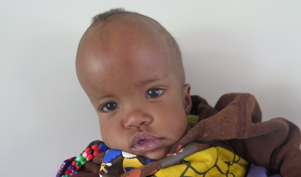 Photo of Stella post-operation