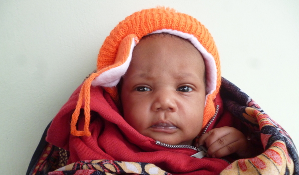Photo of Deborah post-operation