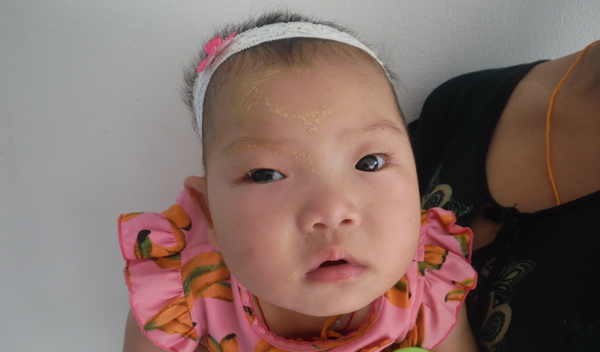 Photo of Aye post-operation