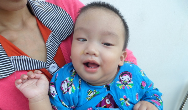 Photo of Thu Rain post-operation