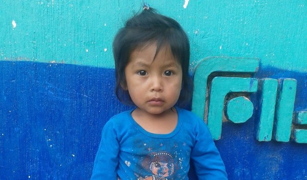 Photo of Manuela post-operation