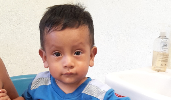 Photo of Eliezer post-operation