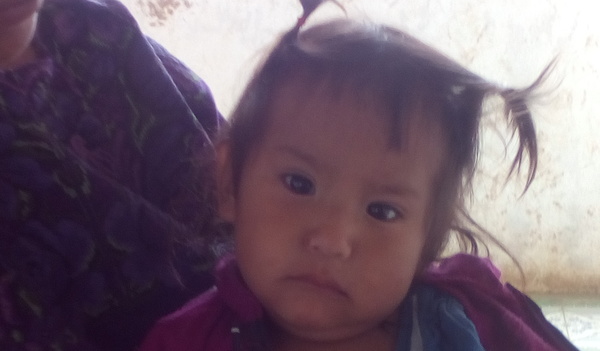 Photo of Zoila post-operation