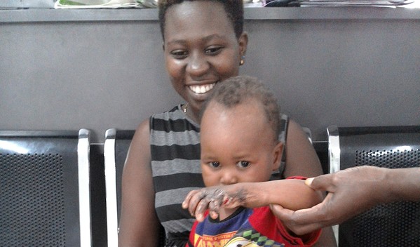 Photo of Godwin Kimaro post-operation