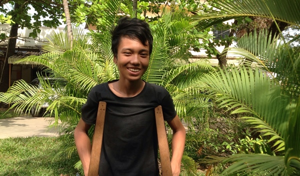 Photo of Khoeur post-operation