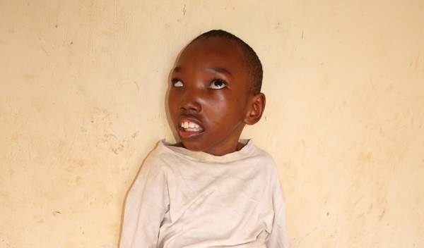 Photo of Emmanuel post-operation