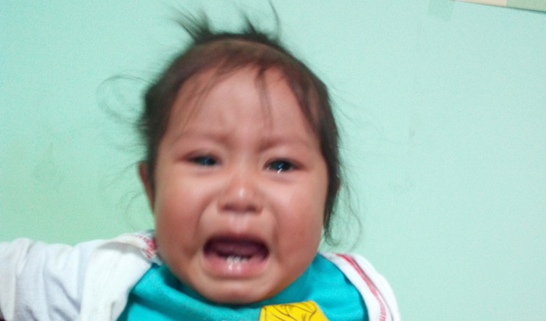 Photo of Iris post-operation