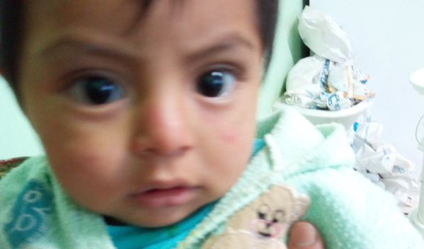 Photo of Carlos post-operation