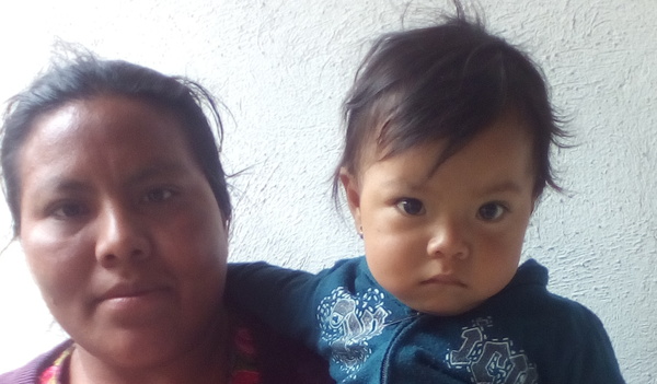 Photo of Vanesa post-operation