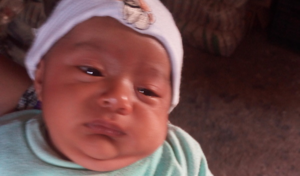 Photo of Eduar post-operation
