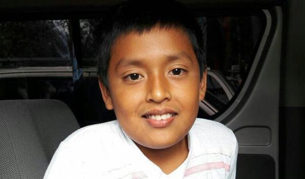 Photo of Carlos post-operation