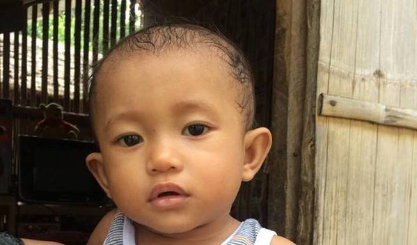 Photo of Radin post-operation