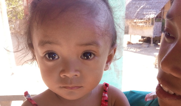 Photo of Jenelyn post-operation