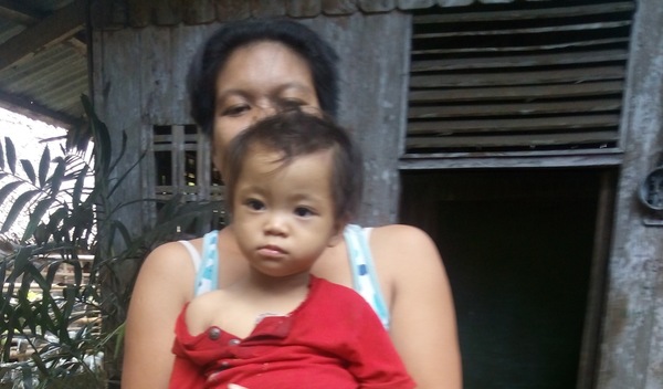 Photo of Shiela post-operation